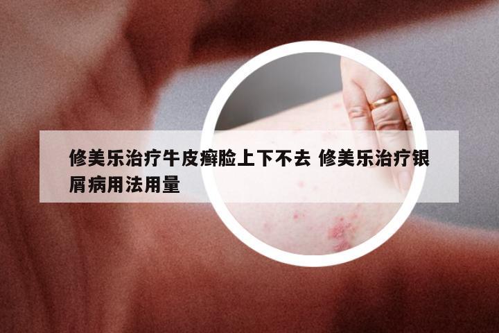 修美乐治疗牛皮癣脸上下不去 修美乐治疗银屑病用法用量