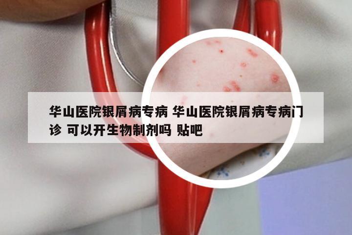 华山医院银屑病专病 华山医院银屑病专病门诊 可以开生物制剂吗 贴吧