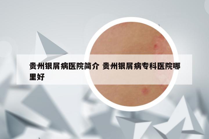 贵州银屑病医院简介 贵州银屑病专科医院哪里好