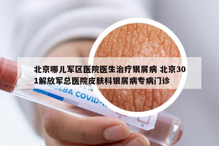 北京哪儿军区医院医生治疗银屑病 北京301解放军总医院皮肤科银屑病专病门诊