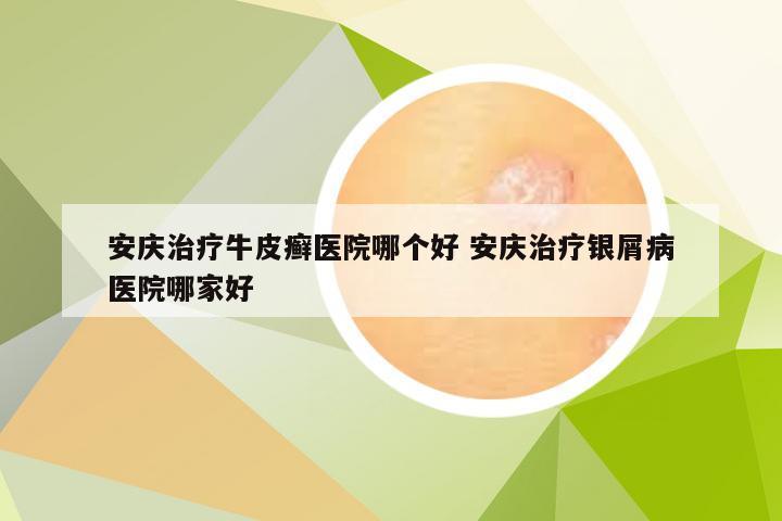 安庆治疗牛皮癣医院哪个好 安庆治疗银屑病医院哪家好