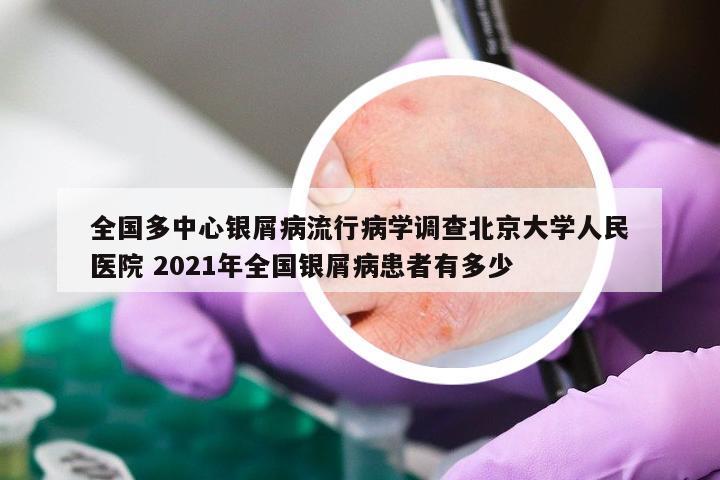 全国多中心银屑病流行病学调查北京大学人民医院 2021年全国银屑病患者有多少