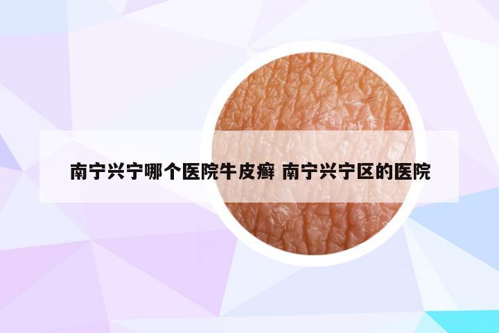 南宁兴宁哪个医院牛皮癣 南宁兴宁区的医院