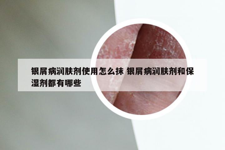 银屑病润肤剂使用怎么抹 银屑病润肤剂和保湿剂都有哪些