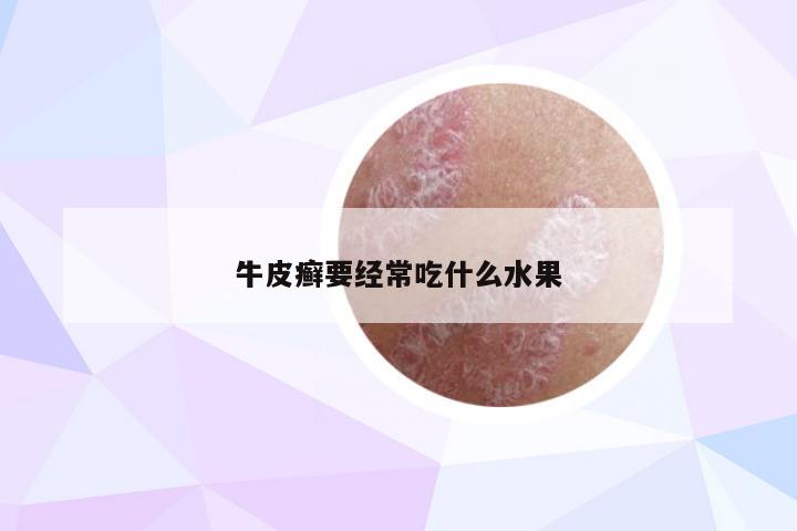 牛皮癣要经常吃什么水果