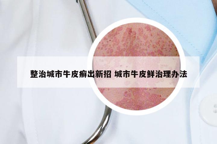 整治城市牛皮癣出新招 城市牛皮鲜治理办法