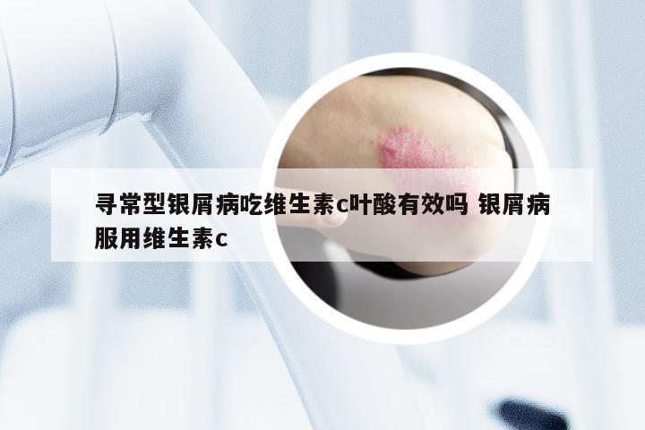 寻常型银屑病吃维生素c叶酸有效吗 银屑病服用维生素c