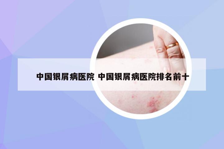 中国银屑病医院 中国银屑病医院排名前十