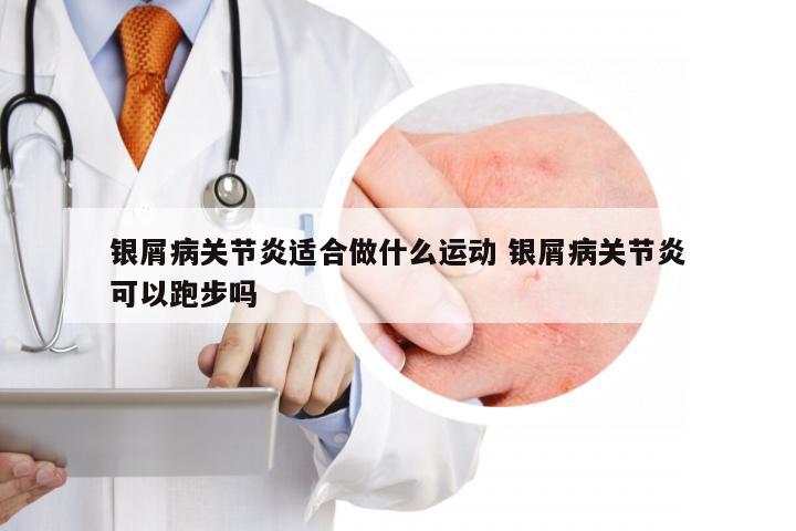 银屑病关节炎适合做什么运动 银屑病关节炎可以跑步吗
