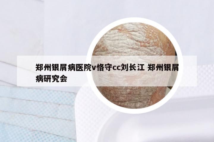 郑州银屑病医院v恪守cc刘长江 郑州银屑病研究会