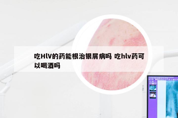 吃HlV的药能根治银屑病吗 吃hlv药可以喝酒吗