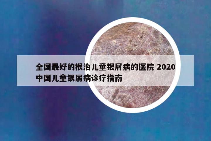 全国最好的根治儿童银屑病的医院 2020中国儿童银屑病诊疗指南