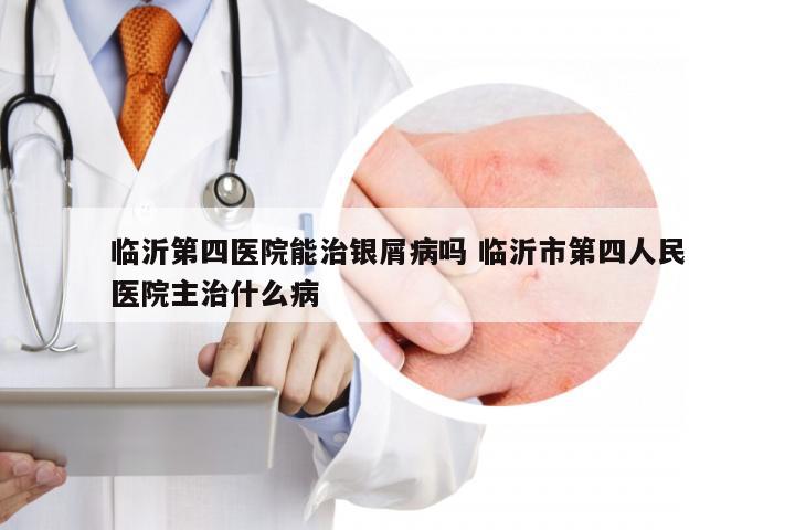 临沂第四医院能治银屑病吗 临沂市第四人民医院主治什么病