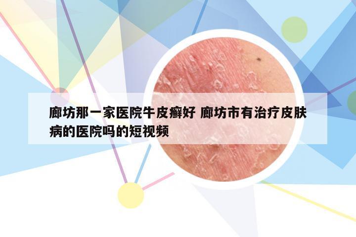廊坊那一家医院牛皮癣好 廊坊市有治疗皮肤病的医院吗的短视频