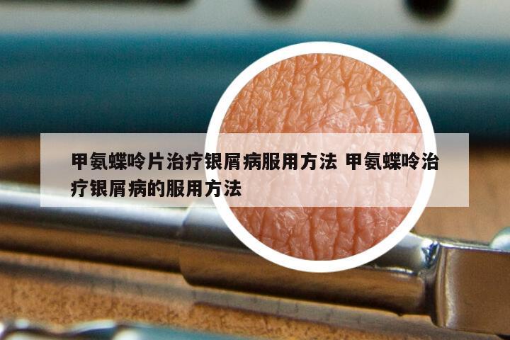 甲氨蝶呤片治疗银屑病服用方法 甲氨蝶呤治疗银屑病的服用方法