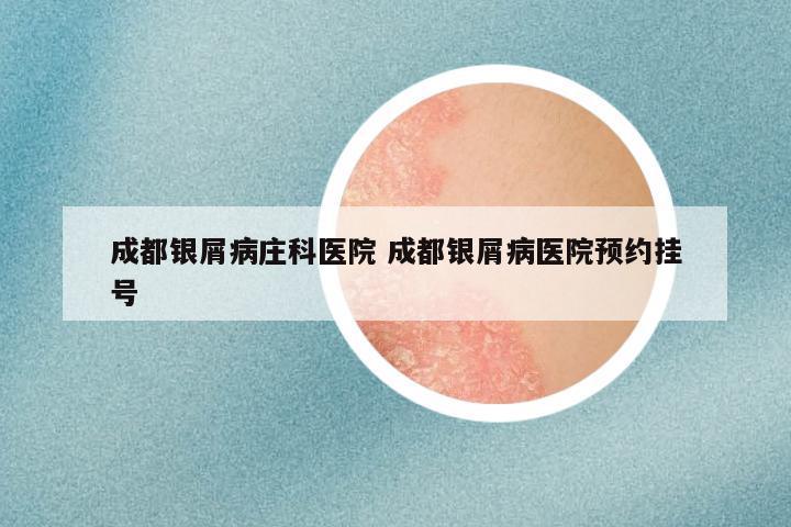 成都银屑病庄科医院 成都银屑病医院预约挂号