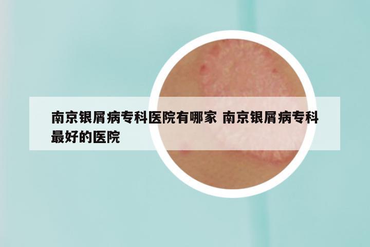 南京银屑病专科医院有哪家 南京银屑病专科最好的医院