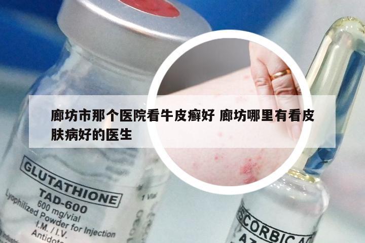 廊坊市那个医院看牛皮癣好 廊坊哪里有看皮肤病好的医生