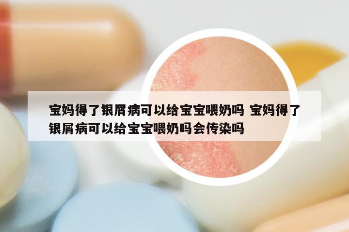 宝妈得了银屑病可以给宝宝喂奶吗 宝妈得了银屑病可以给宝宝喂奶吗会传染吗