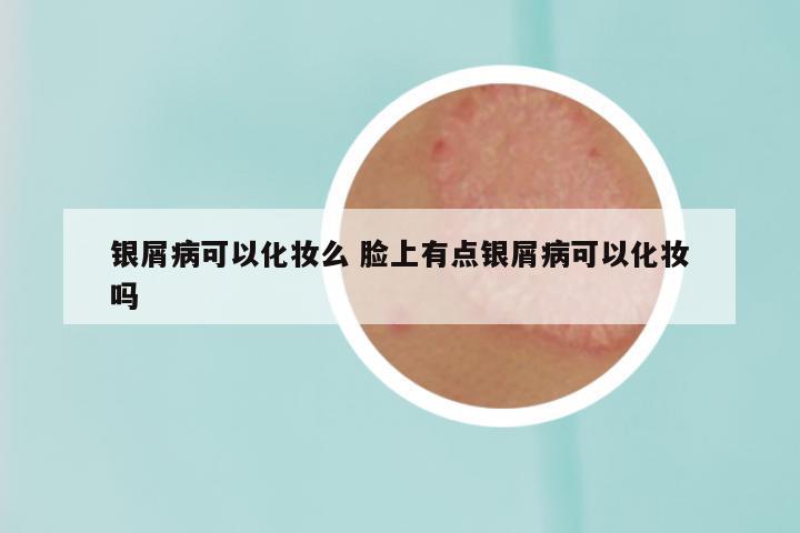 银屑病可以化妆么 脸上有点银屑病可以化妆吗