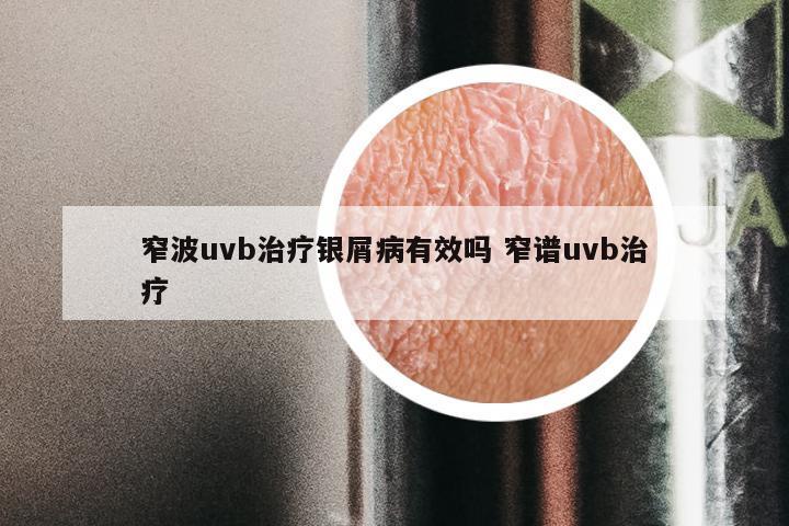 窄波uvb治疗银屑病有效吗 窄谱uvb治疗