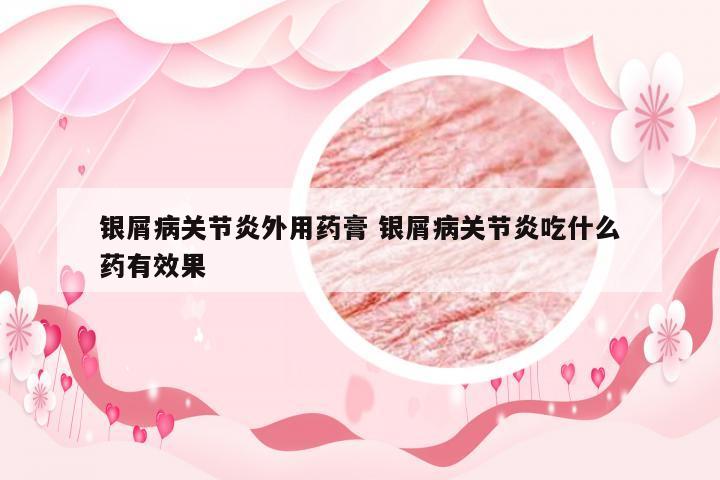 银屑病关节炎外用药膏 银屑病关节炎吃什么药有效果