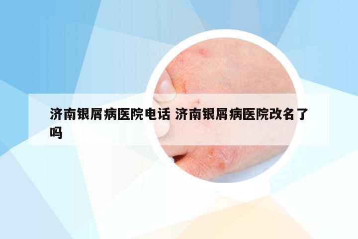 济南银屑病医院电话 济南银屑病医院改名了吗