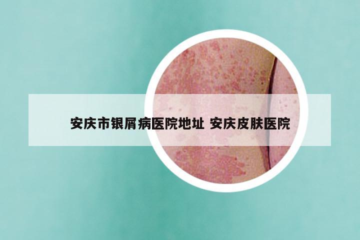 安庆市银屑病医院地址 安庆皮肤医院