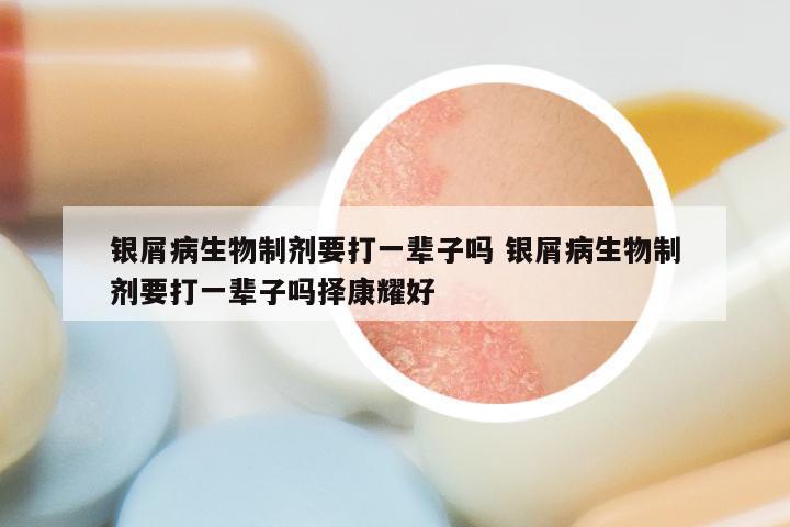 银屑病生物制剂要打一辈子吗 银屑病生物制剂要打一辈子吗择康耀好