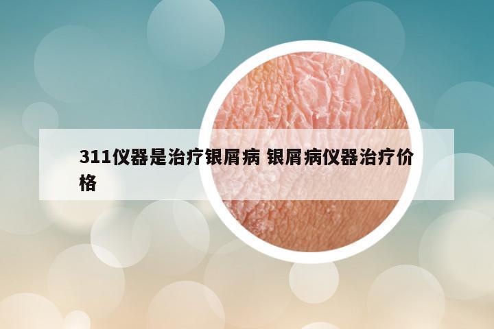 311仪器是治疗银屑病 银屑病仪器治疗价格