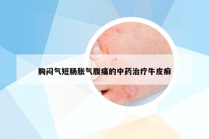 胸闷气短肠胀气腹痛的中药治疗牛皮癣