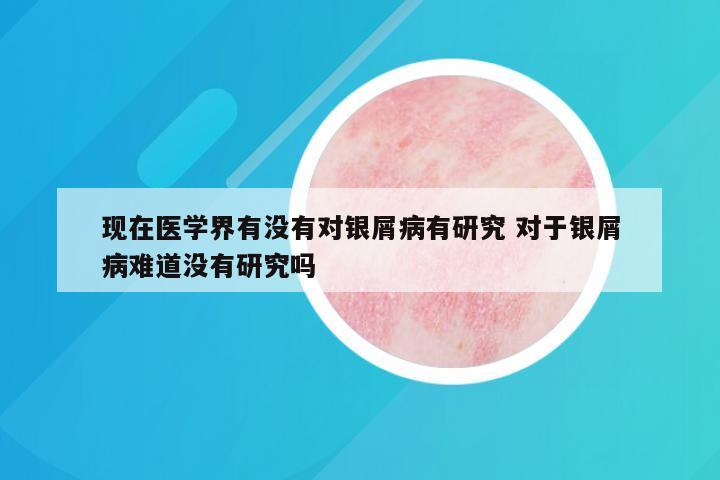 现在医学界有没有对银屑病有研究 对于银屑病难道没有研究吗