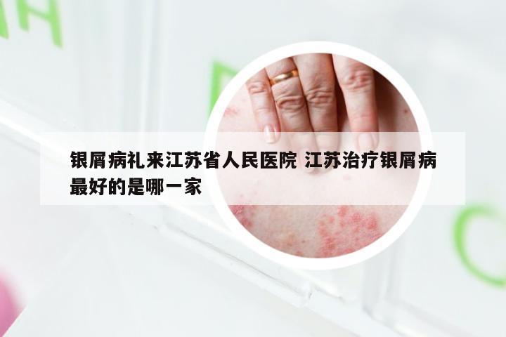 银屑病礼来江苏省人民医院 江苏治疗银屑病最好的是哪一家