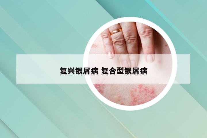 复兴银屑病 复合型银屑病