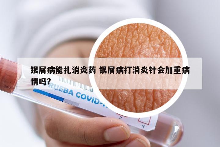 银屑病能扎消炎药 银屑病打消炎针会加重病情吗?
