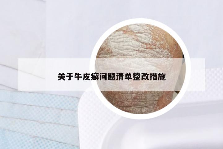 关于牛皮癣问题清单整改措施