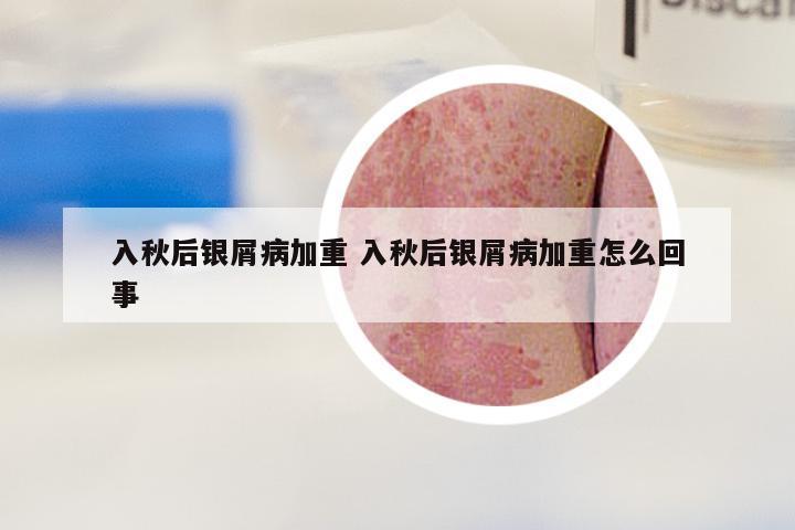 入秋后银屑病加重 入秋后银屑病加重怎么回事