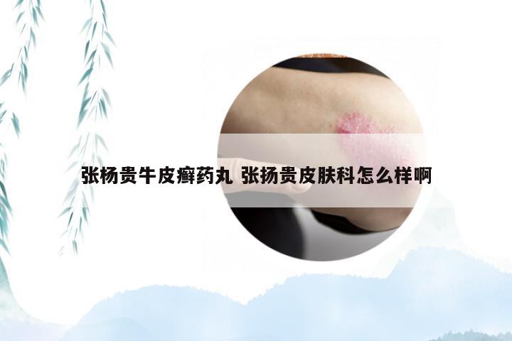张杨贵牛皮癣药丸 张扬贵皮肤科怎么样啊