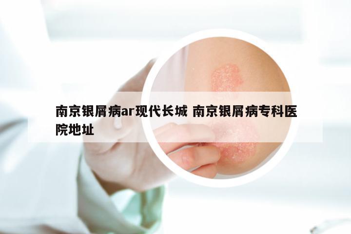 南京银屑病ar现代长城 南京银屑病专科医院地址