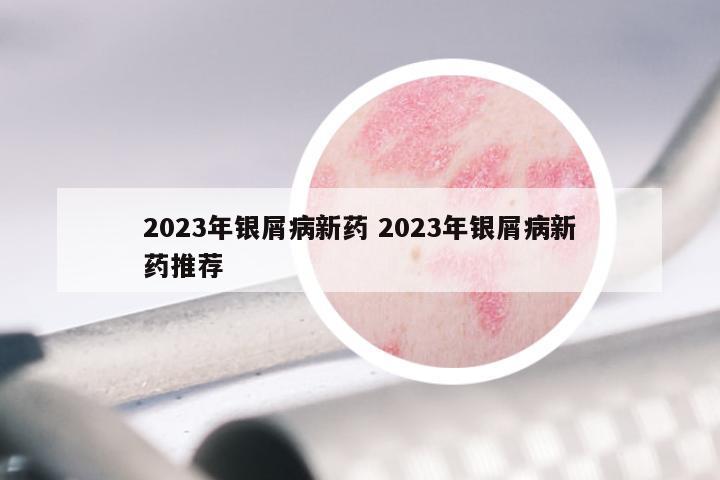 2023年银屑病新药 2023年银屑病新药推荐