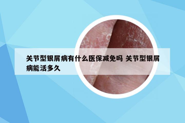 关节型银屑病有什么医保减免吗 关节型银屑病能活多久