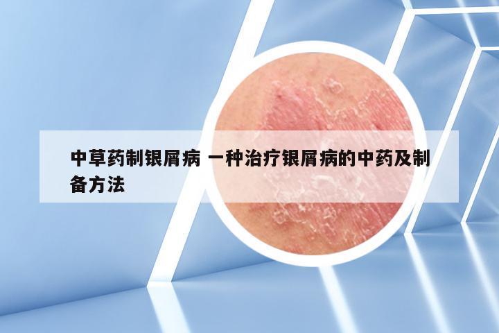 中草药制银屑病 一种治疗银屑病的中药及制备方法
