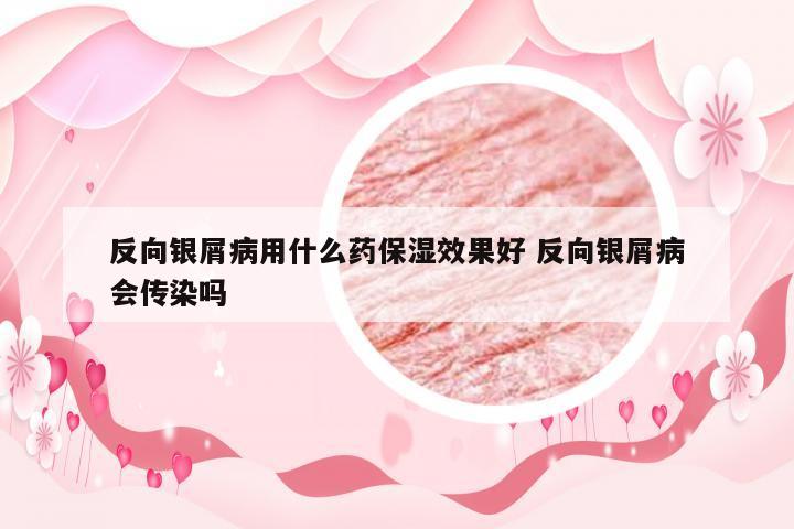 反向银屑病用什么药保湿效果好 反向银屑病会传染吗