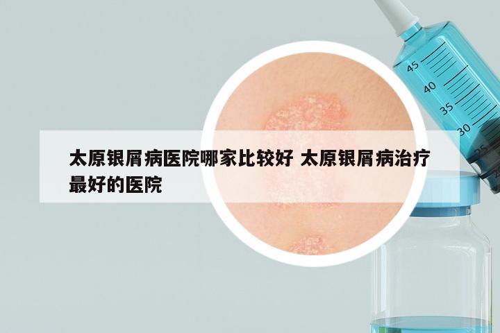 太原银屑病医院哪家比较好 太原银屑病治疗最好的医院