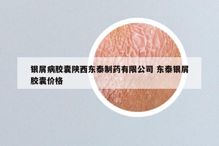 银屑病胶囊陕西东泰制药有限公司 东泰银屑胶囊价格