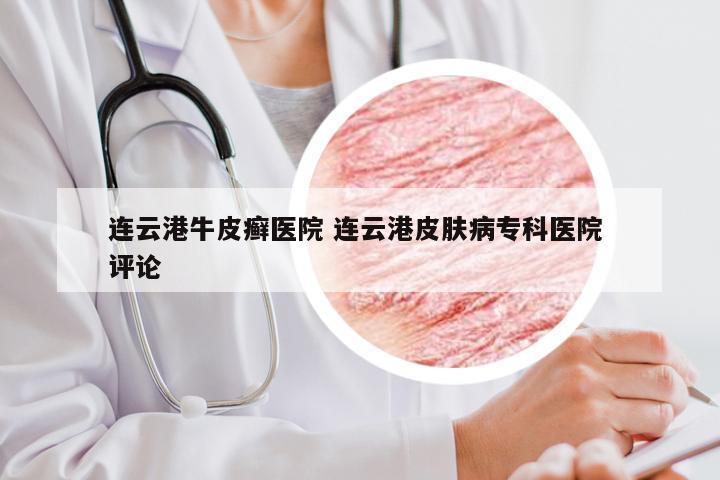 连云港牛皮癣医院 连云港皮肤病专科医院 评论