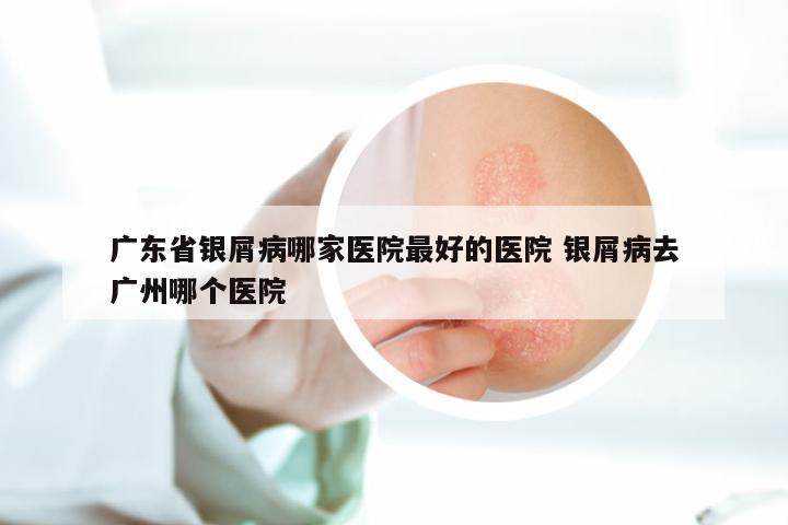 广东省银屑病哪家医院最好的医院 银屑病去广州哪个医院