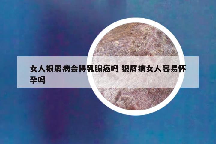 女人银屑病会得乳腺癌吗 银屑病女人容易怀孕吗