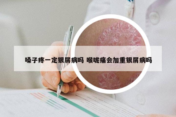 嗓子疼一定银屑病吗 喉咙痛会加重银屑病吗