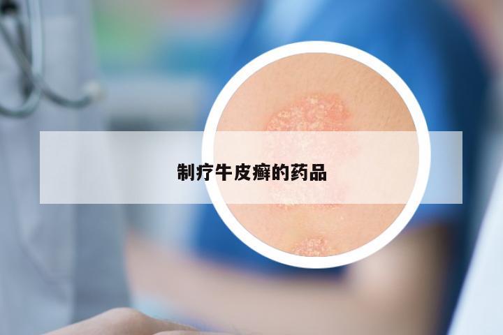 制疗牛皮癣的药品